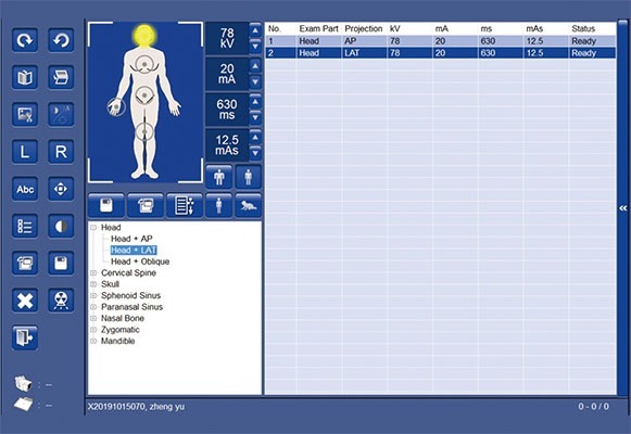 Logiciel du système de radiographie numérique portable SIUI SR 1000 importé par Label Médical
